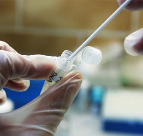 Coleta de amostra em tubo de laboratório