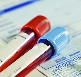 Tubos de coleta sobre pedido de exame